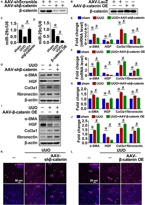 Frontiers The MicroRNA MiR 29c Alleviates Renal Fibrosis Via TPM1