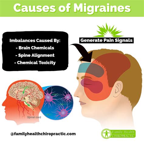 Migraine headaches symptoms causes treatment – Artofit