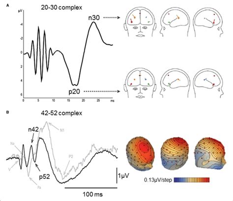 Middle Latency Vestibular Evoked Cerebral Potentials Vesteps A