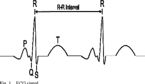 Figure 1 From ECG Signal Compression Using Hybrid 1D And 2D Wavelet