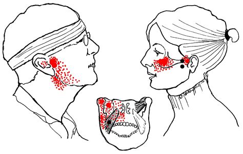 The Causes of Ear Pain