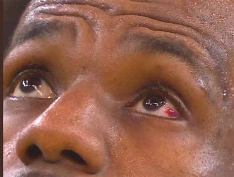 Lebron James Has Damaged Eye From Draymond Green Foul Larry Brown Sports