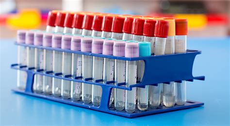 Bd Vacutainer Urinalysis Tube Prime Dental Supply Off Hot Sex Picture