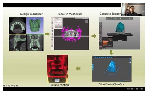 Dental 3d Printing The Ultimate Guide 3dheals