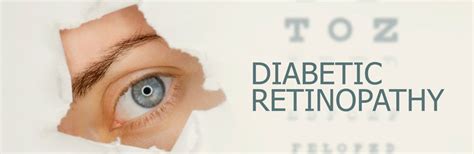 Diabetic Retinopathy Symptoms Causes And Prevention