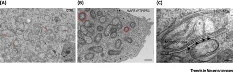 Electron Microscope Images of Endoplasmic Reticulum (ER)-–Mitochondria ...