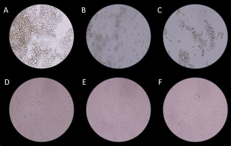 SciELO Brazil Cell Detachment Rates And Confluence Of Fibroblast And