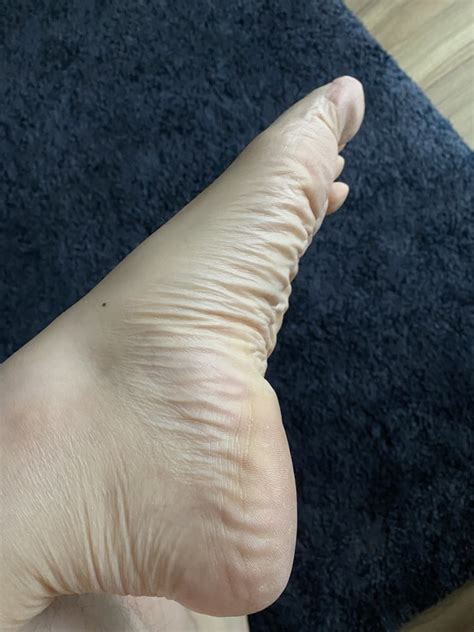 My Orgasmic Feet And Soles Pics Xhamster