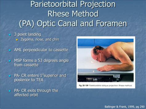 Ppt Radiography Of The Orbits Powerpoint Presentation Free Download