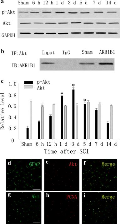 The Correlation Of Akr B With Akt After Injury A Akt And P Akt Level