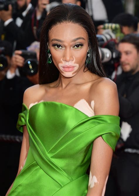 Winnie Harlow Net Worth Insights And Financial Journey