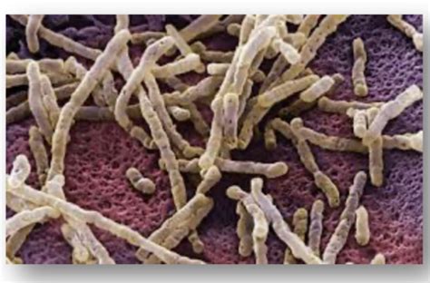 INFECTIVE PATHOLOGY CASE STUDY CPP Flashcards Quizlet