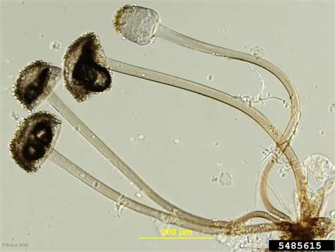 Rhizopus Spp Structure Life Cycle Habitat Pathogenesis Biology