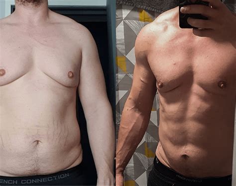 Gynecomastia Before And After Exercise