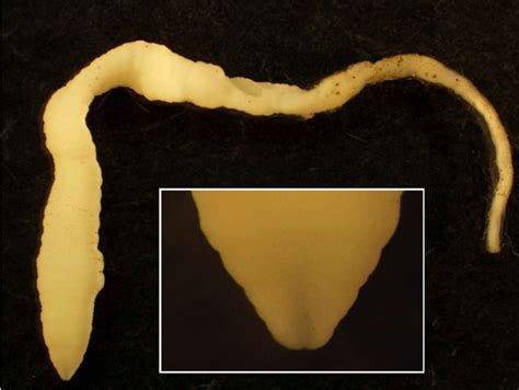 Figure 3 From Thirty Seven Human Cases Of Sparganosis From Ethiopia And