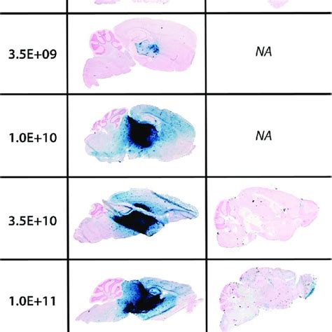 Spatial Distribution Of B Gal Enzyme In The Mouse Cns At Month