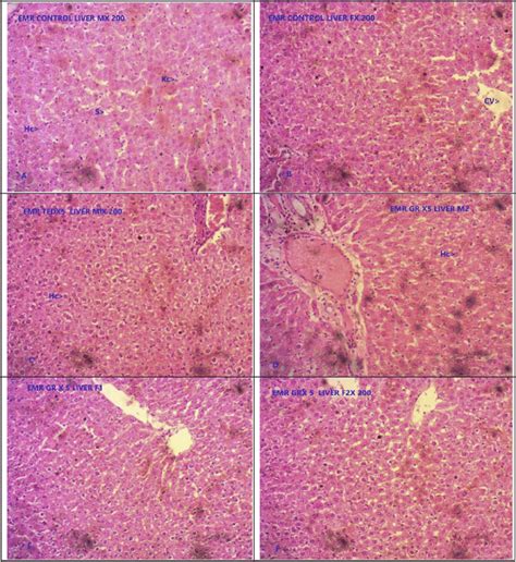 Photomicrograph Of Representative Sections Of Liver Tissues A