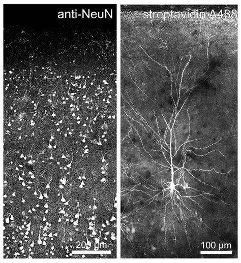 Synaptic Plasticity In Adult Human Cortical Neurons Neuroanatomy