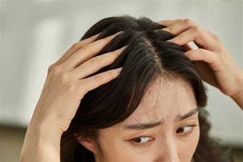 How To Get Rid Of Scabs On Scalp A Step By Step Guide To Healthy Hair