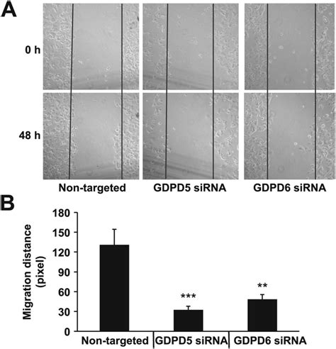 GDPD5 And GDPD6 Silencing Reduced MCF 7 Cell Migration A