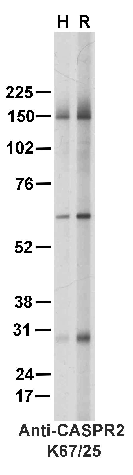 Addgene Antibody Data Hub Anti CASPR2 K67 25R In Western Blot Rat