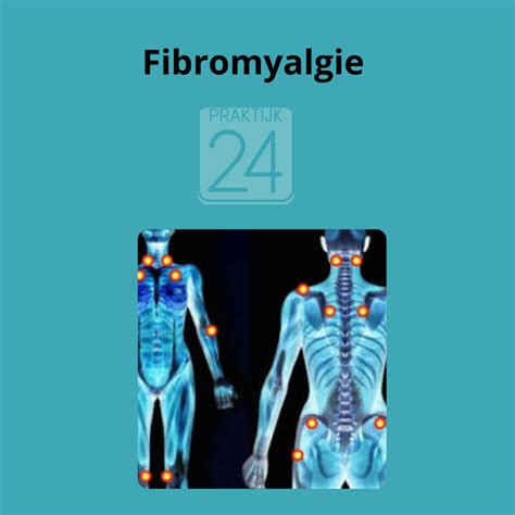 Fibromyalgie Praktijk 24