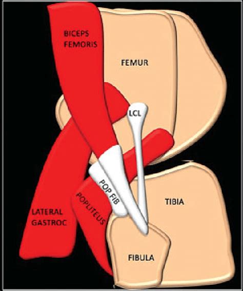 Schematic Showing The Posterolateral Corner Structures Pop Fib