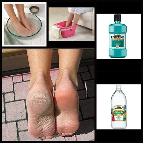 Soin de pied Une pédicure maison facile Feet care Beauty hacks