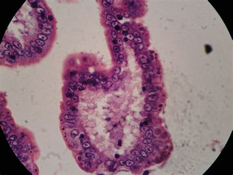 Phylum Apicomplexa