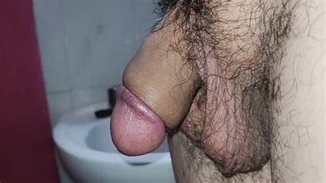 10 Days After Circumcision Pornhub Gay