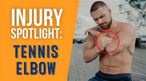 What Is Tennis Elbow Lateral Epicondylitis Youtube