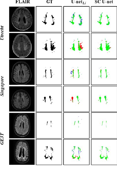 Figure 2 From Skip Connection U Net For White Matter Hyperintensities