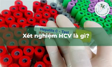 Test HCV là gì Ý nghĩa và Quy trình xét nghiệm viêm gan C