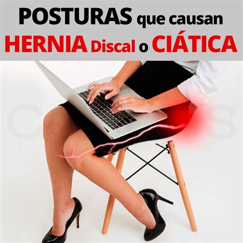 Malas Posturas Al Sentarse Causan Hernia Discal O Ciática Cordus Eeuu