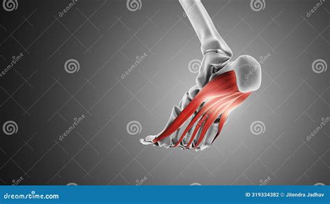 Plantar Fascia Inflammation And Dysfunction Syndrome Royalty Free Stock