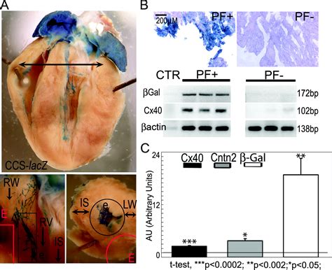 Contactin 2 Expression In The Cardiac Purkinje Fiber Network