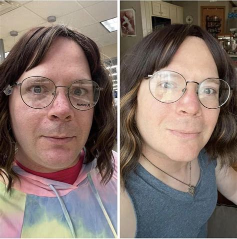 6 Months Makes A Difference Left Is 7 Weeks Hrt I M So Much Happier R Transtimelines