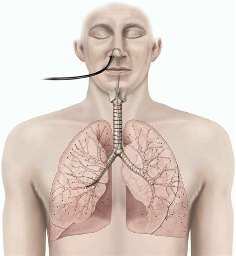 Transbronchial Biopsy Healthdirect