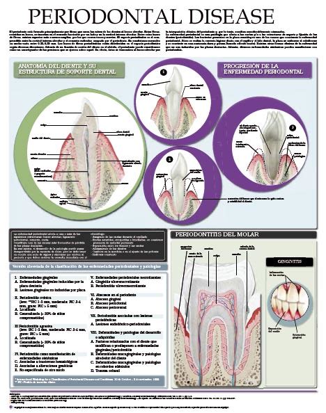 Stages Of Periodontal Disease Chart