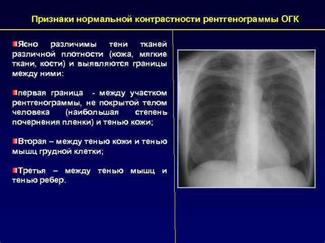 РЕНТГЕНОГРАММА ГРУДНОЙ КЛЕТКИ В НОРМЕ РЕНТГЕНОГРАФИЯ ОРГАНОВ