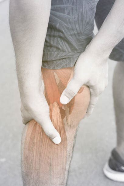 Best Swollen Knee Stock Photos, Pictures & Royalty-Free Images - iStock