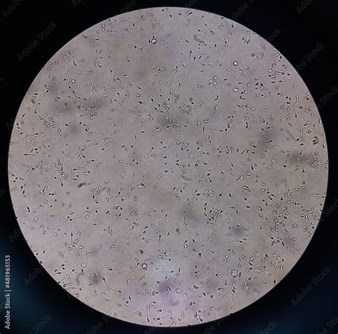 Sperm Morphology Semen Photo Under Microscope Micrograph Showing