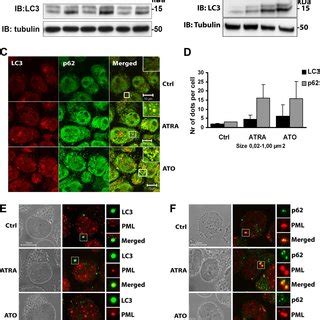 Atra And Ato Induce Autophagy Dependent Degradation Of Pml Rara A