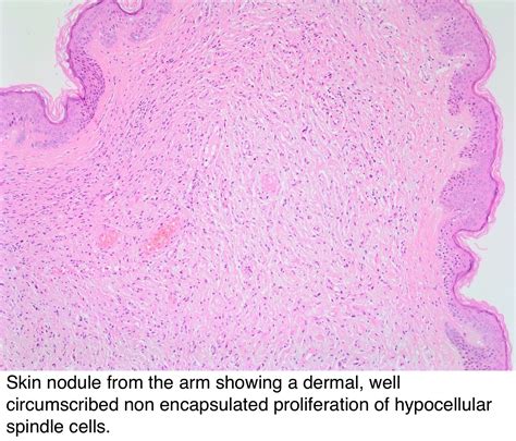 Pathology Outlines Histology
