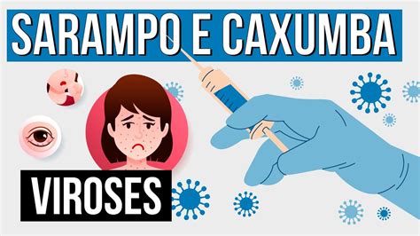 SARAMPO E CAXUMBA Tipos De Viroses Resumo De Biologia Para O Enem