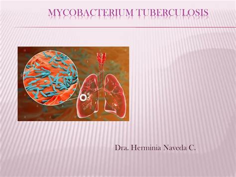 Mycobacterium Tuberculosis Vivianne Ni O De Guzman Miraval Udocz