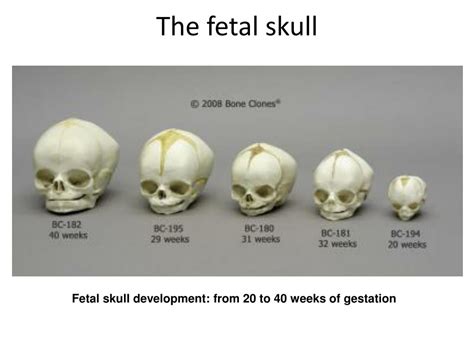 PPT - The Skull & Axial Skeleton PowerPoint Presentation, free download ...