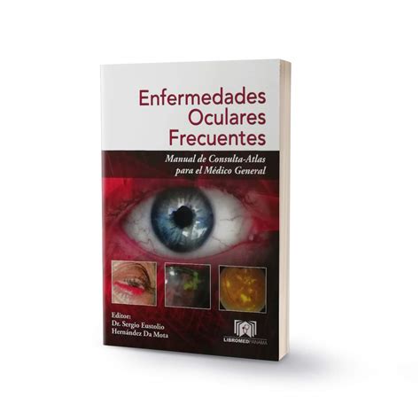 Enfermedades Oculares Frecuentes Manual De Consulta Atlas Para El