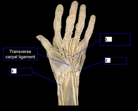 Answered 1 Transverse Carpal Ligament Bartleby