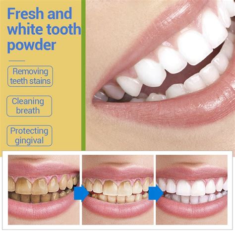 Your Mouth Deserves The Best Fresh Breath And White Teeth Health